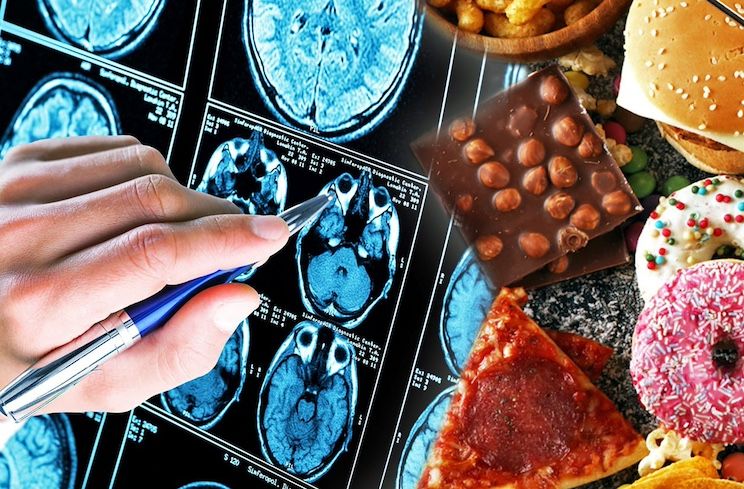 Official Study Finds Processed Foods Cause Dementia, Alzheimers [Video]