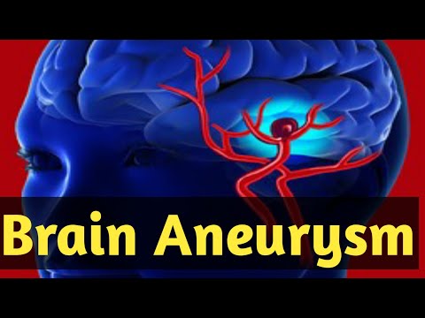 what is a brain aneurysm – brain aneurysm symptoms, what causes brain aneurysm, Treatment [Video]