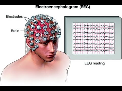 Electroencephalograph  / Electroencephalogram as a diagnostic modality [Video]