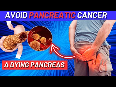 Pancreas Is Dying! 12 Early Signs of Pancreatic Cancer & Tips to Avoid It [Video]
