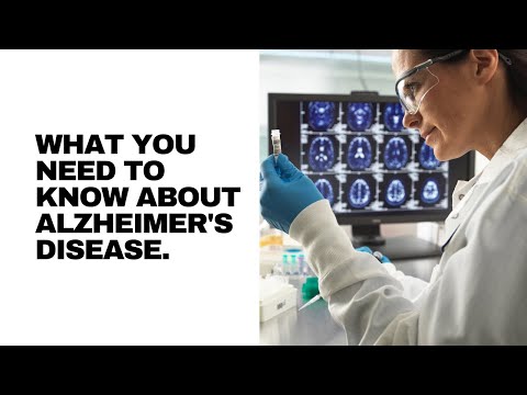 Understanding Alzheimer’s Disease  [Video]