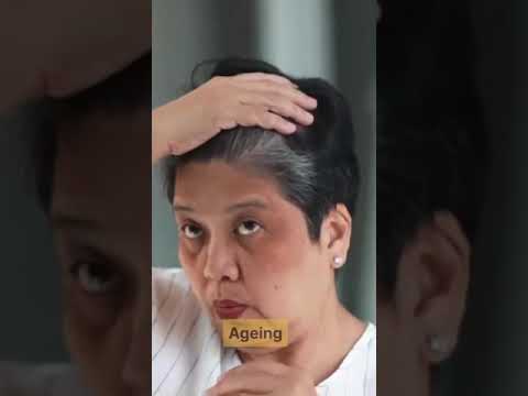 Understanding Dementia [Video]