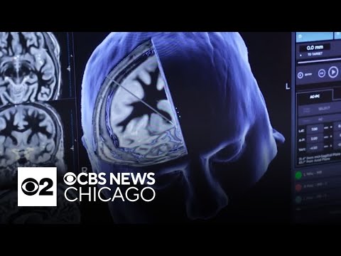 Recognizing the warning signs of Parkinson’s disease [Video]