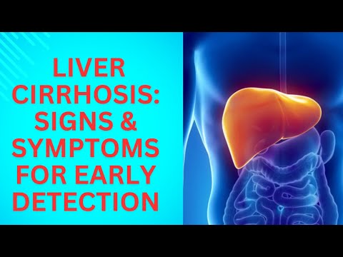 Liver Cirrhosis  Signs and Symptoms for Early Detection [Video]