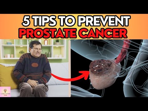 5 IMPORTANT Tips to Prevent PROSTATE CANCER | Early Detection [Video]