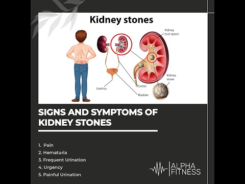Signs and symptoms of kidney stones [Video]