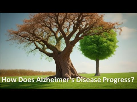 How Does Alzheimer’s Disease Progress? [Video]