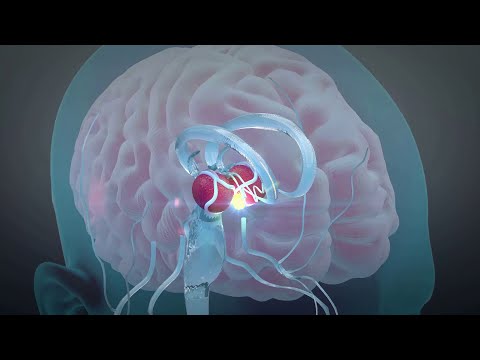 10 Habits Destroying Your Brain Health! [Video]