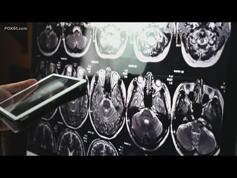 New Alzheimer’s research, mental health awareness, and preventing drownings | Health Watch [Video]
