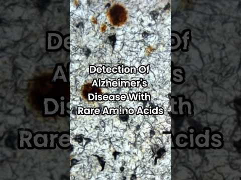 How Amino Acids help to detect Alzheimers [Video]