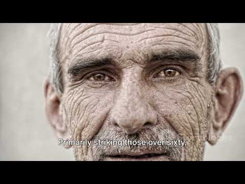 Alzheimer’s Disease [Video]