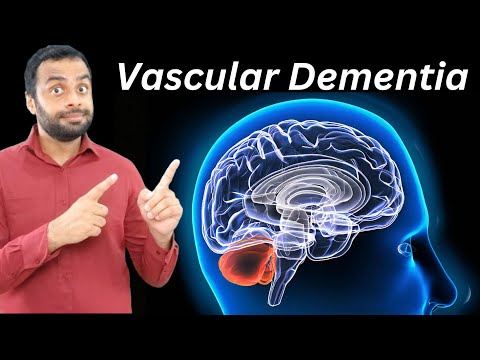 What Is Vascular Dementia? [Video]