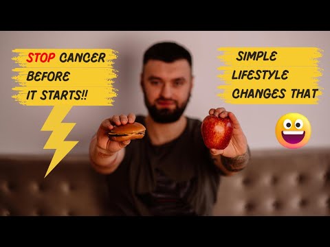 Stop Cancer Before It Starts: Simple Lifestyle Changes That Work!! [Video]