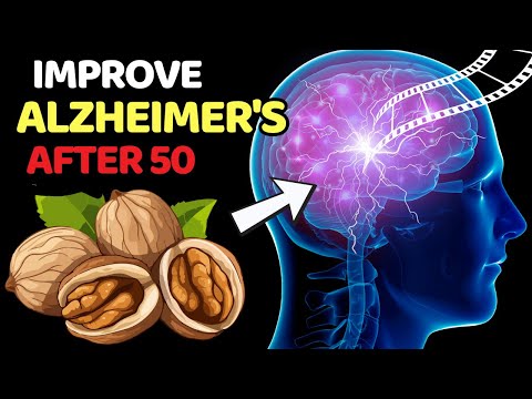Improve Alzheimer’s After Age 50 With Just 10 Simple Foods. | Vitality Solutions [Video]