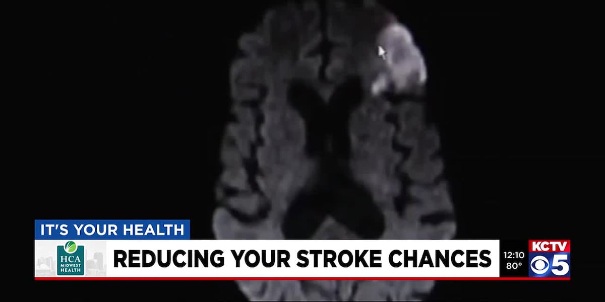 It’s Your Health: Reducing Your Stroke Chances [Video]
