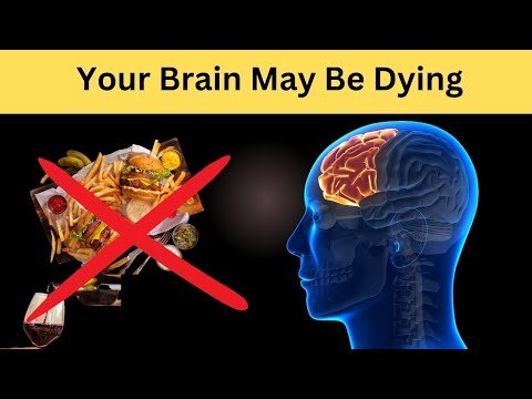Stop These 9 Habits. Your Brain May Be Dying [Video]
