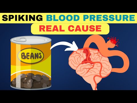 6 Shocking Reasons Your Blood Pressure Is Spiking (And How to Fix It!) [Video]