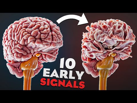 10 Silent Warning Signs That You’re About To Get Dementia [Video]