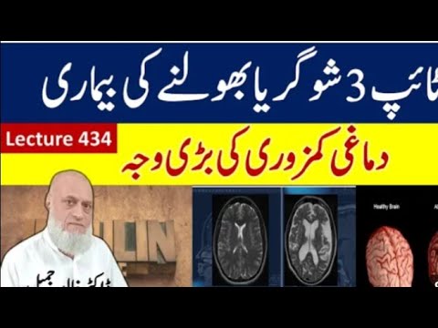 Alzheimer’s disease in detail | alzheimer’s disease | alzheimer’s | dementia [Video]