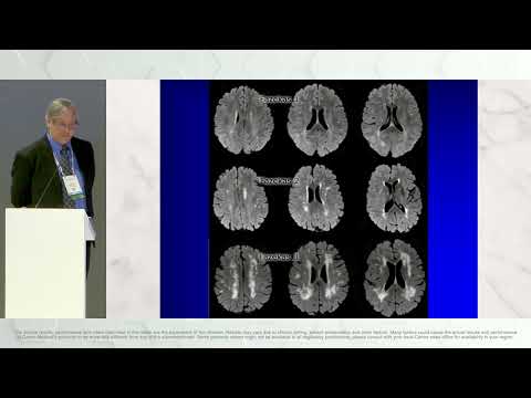 RSNA PET/CT – AI Driven Image Acquisition and Analysis for Dementia Diagnosis [Video]