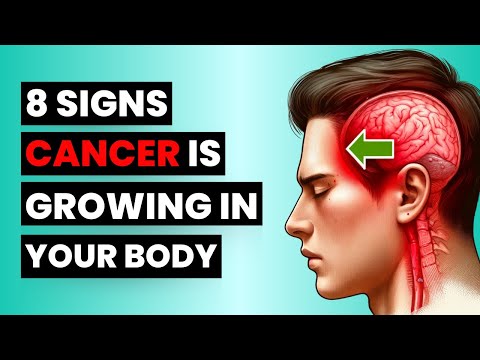 Don’t Miss These 8 Early Cancer Signs – It Could Save You! [Video]