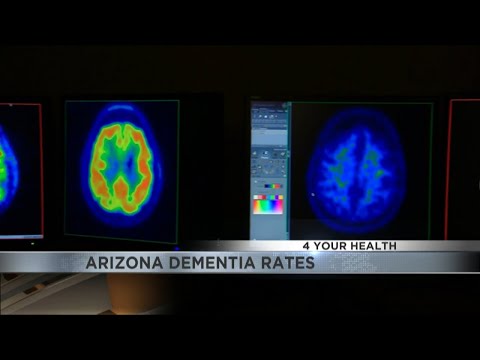 Arizona has fastest-growing rates for Alzheimer’s disease in country [Video]