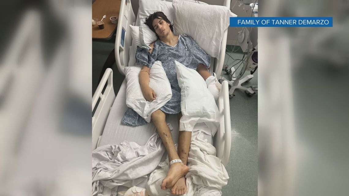 Teen motorcycle crash survivor thanks medics who saved his life [Video]