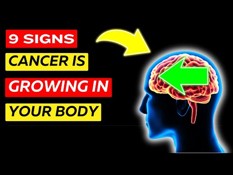 Don’t Miss These 9 Early Cancer Signs – It Could Save You! [Video]