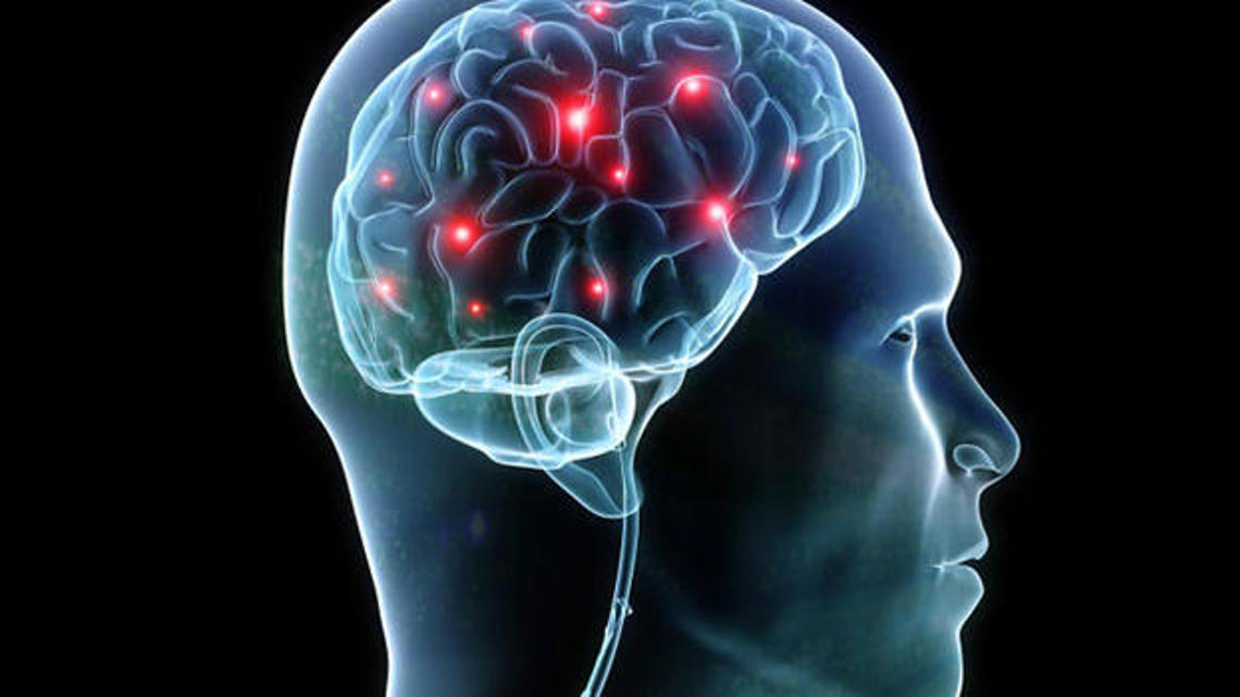 Learn how to keep your brain sharp at Palm Health seminar [Video]