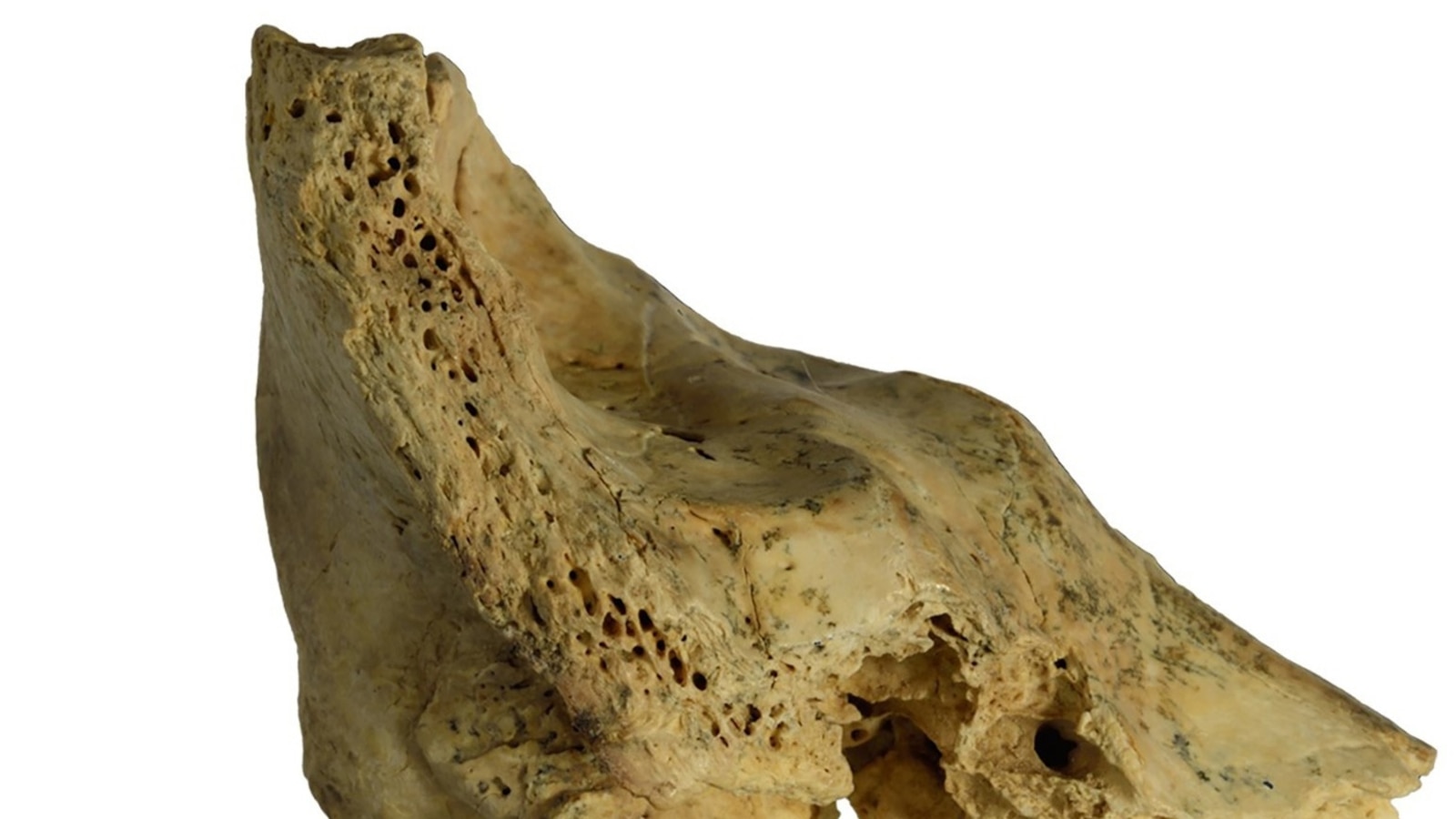 Fossilized skull of Neanderthal child with Down syndrome reveals communal caregiving among species [Video]