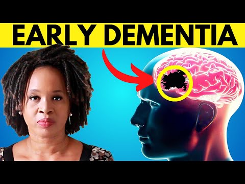 10 Silent Signs You May Already Have Dementia / Alzheimer’s [Video]