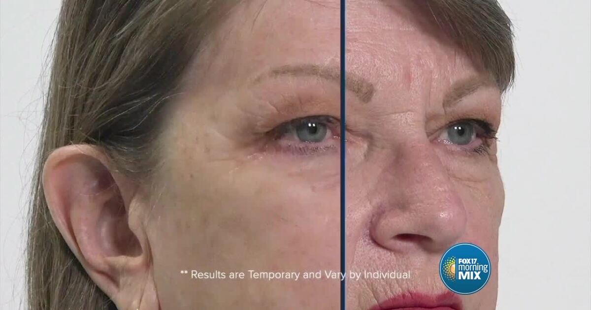 Have your skin look young for summer with Plexaderm [Video]