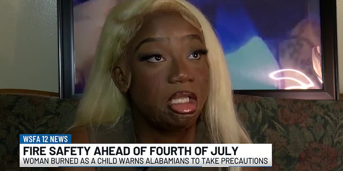 Burn victim urges fire safety ahead of Fourth of July [Video]