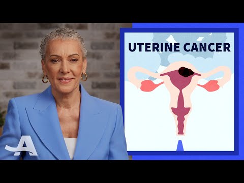 Early Signs of Uterine Cancer [Video]