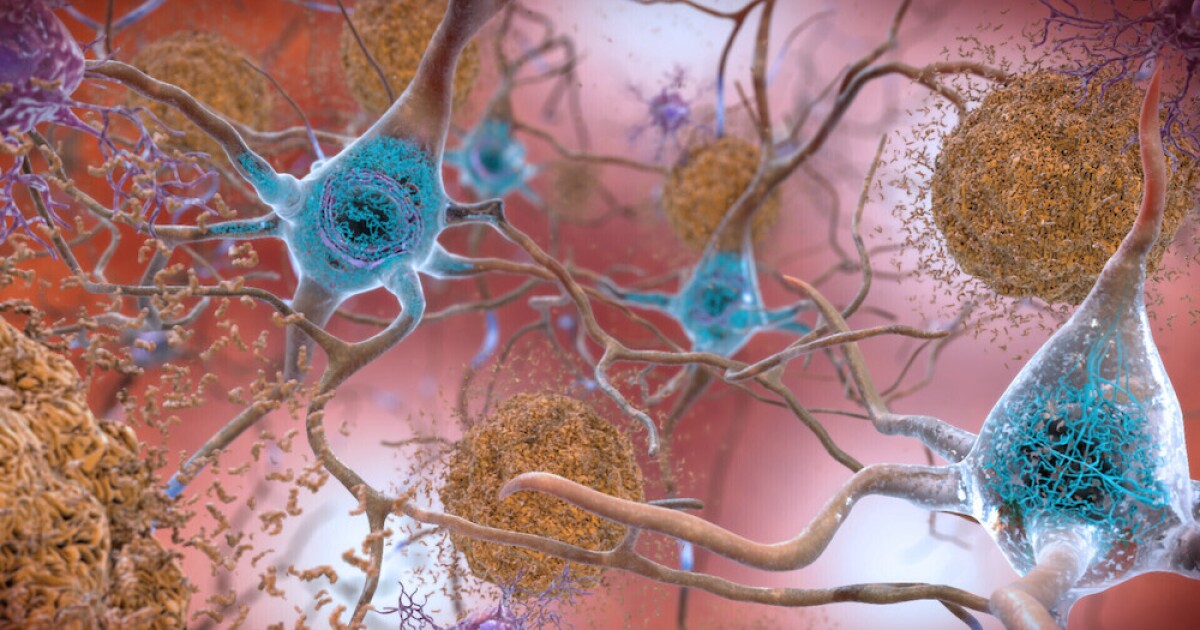 FDA approves Donanemab, new Eli Lilly treatment for early Alzheimers disease [Video]