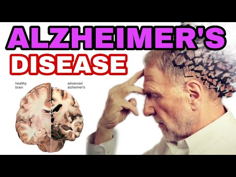 What is Alzheimer’s disease? What Are the Symptoms? “Alzheimer’s disease and related dementias” [Video]
