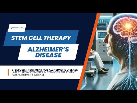 Stem Cell Therapy for Alzheimer
