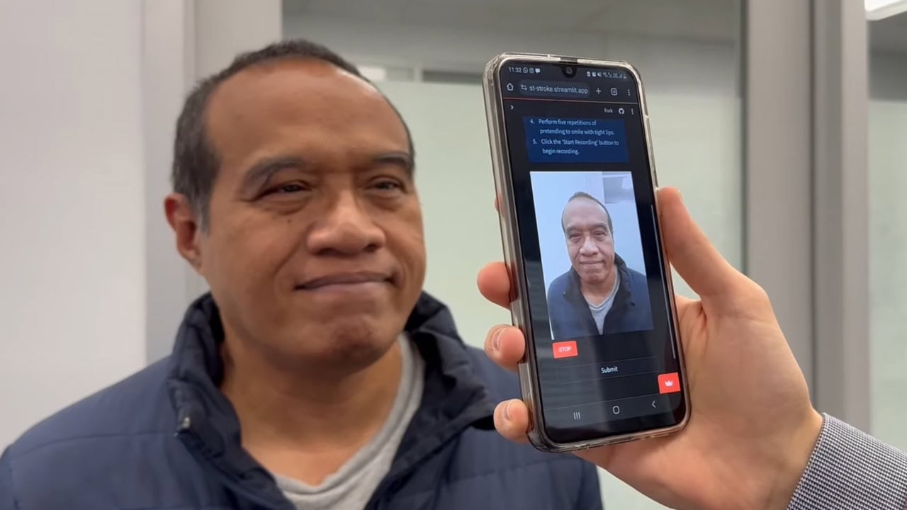 AI-powered smartphone app can help detect strokes [Video]