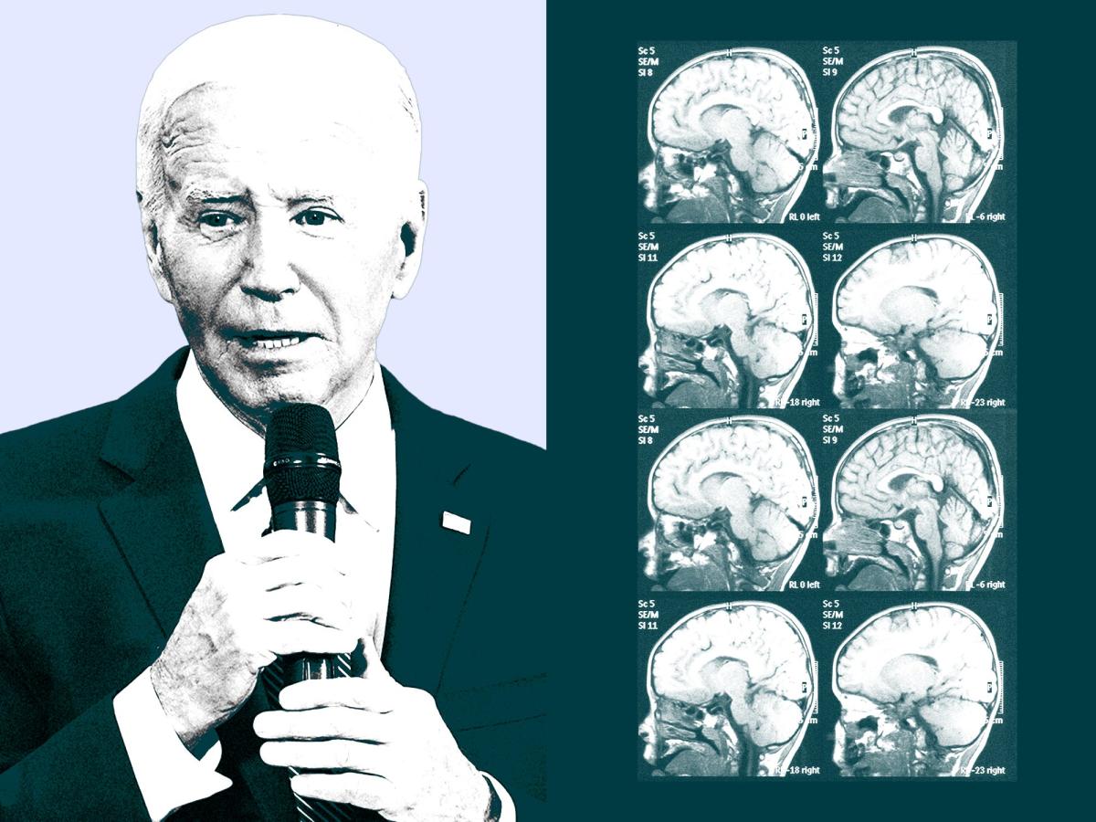 A brain expert explains the cognitive test used to assess a president