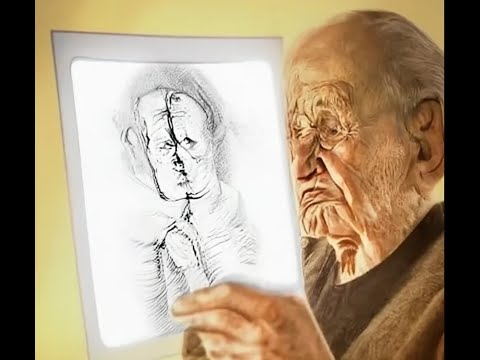 Predicting Cognitive Decline in Early Alzheimer’s – New Study Highlights Potential of Treatments [Video]